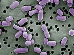 Lactobacillus